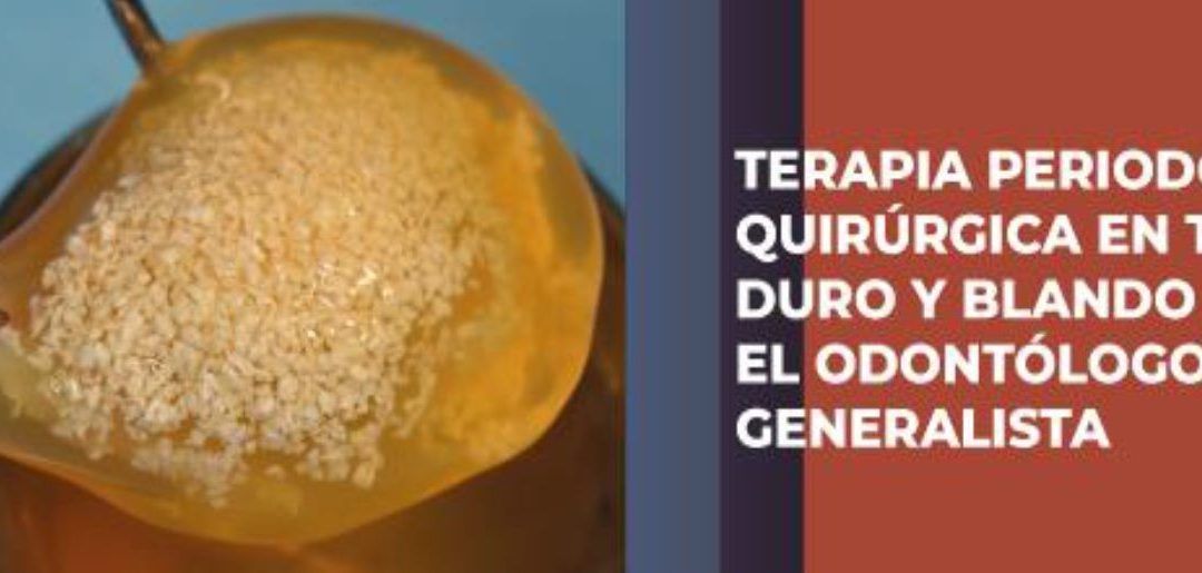 Curso online de Terapia Periodontal Quirúrgica en tejido duro y blando